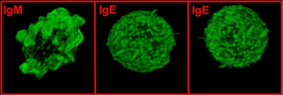 Linfocitos B al microscopio. Los que llevan IgE pierden los pseudópodos, que sí mantienen los que llevan IgB. Fuente: CNRS.