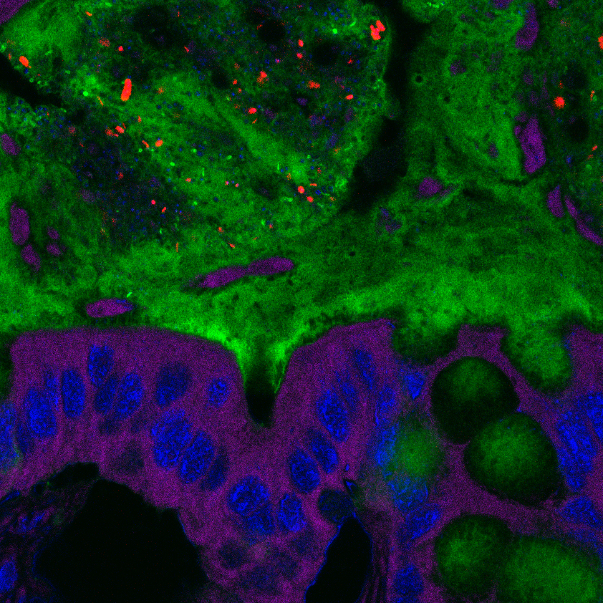 Bacterias en la capa de mucosidad del intestino, más cerca de las células epiteliales de lo que deberían. Imagen: Benoit Chassaing. Fuente: Universidad del Estado de Georgia.