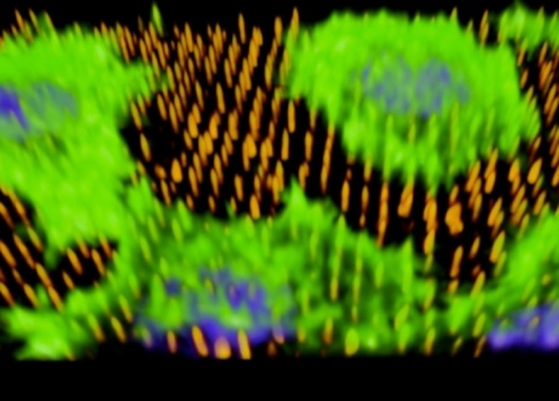 La imagen muestra células humanas (en verde) en nanoagujas (naranja). Los nanoagujas han inyectado ADN en los núcleos de las células (en azul). La imagen fue tomada por los investigadores con microscopía óptica. Fuente: Imperial College London.