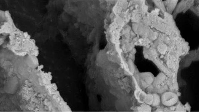 Muestra de microbiota de heces de un individuo sano obtenida mediante microscopio. Fuente: CSIC.
