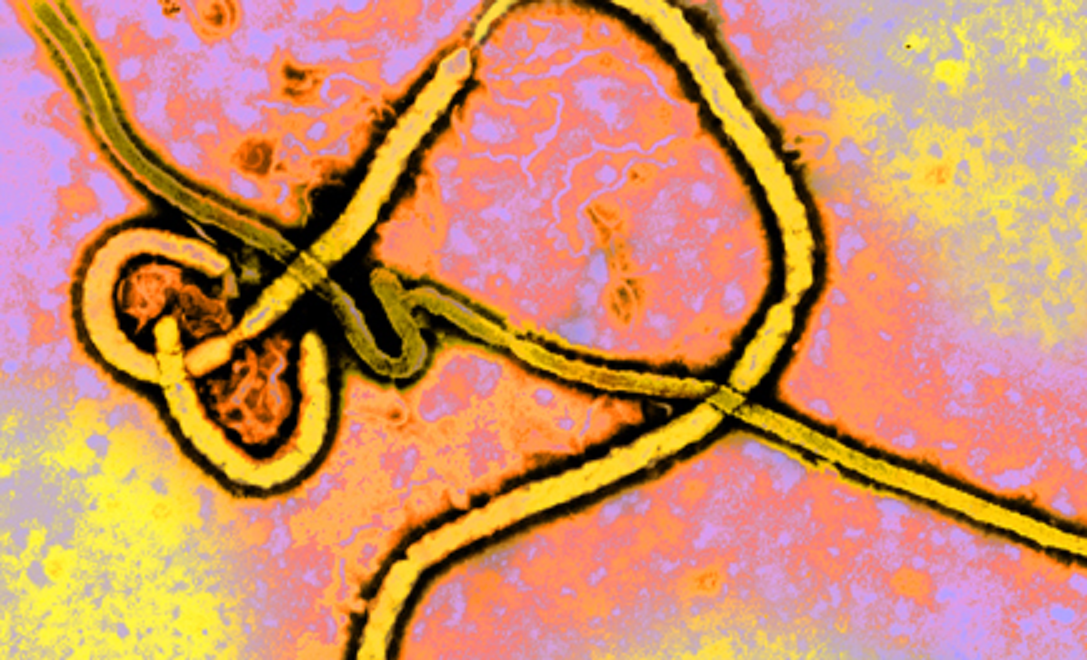 Virus del ébola. Fuente: UTMB.