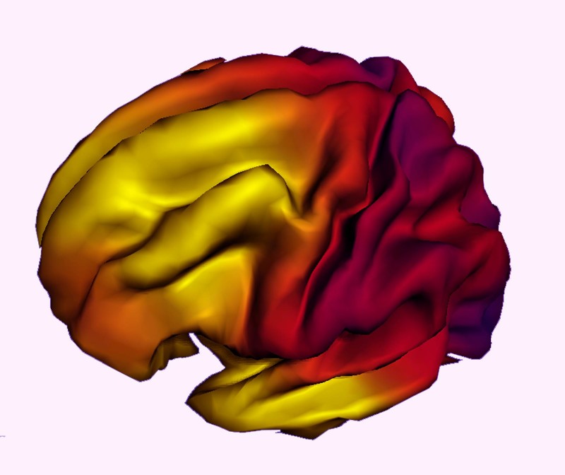 Imagen compuesta que muestra la relación entre la expansión de la superficie del cerebro y la edad en personas de entre 3 y 20 años. Fuente: Hospital Infantil de Los Ángeles.