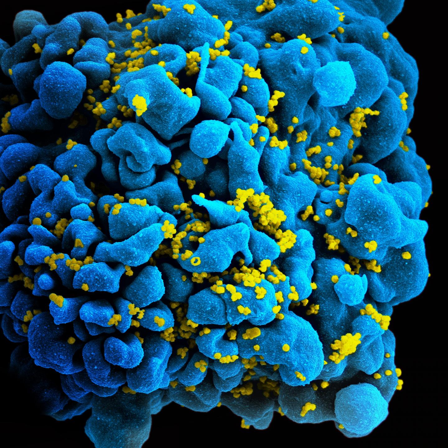 El virus del sida es como una lata herméticamente sellada. Fuente: NIAID. CC BY 2.0.