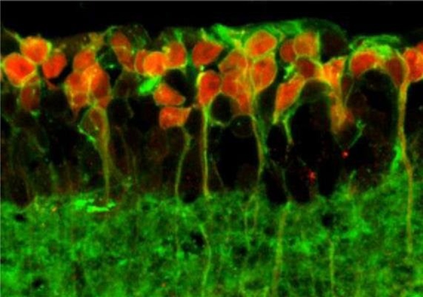 La retina de un ratón ciego tratado con el nuevo método: Una 'antena de la luz' se ha unido a las células (en rojo). Imagen: Sonja Kleinlogel. Fuente: PlosOne.