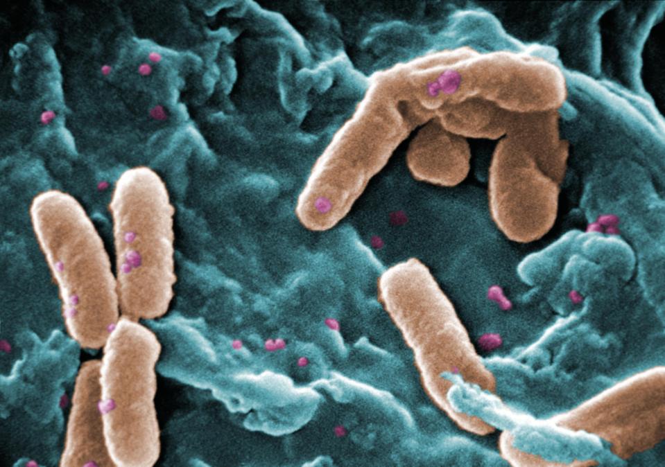 Micrografía electrónica de barrido de la bacteria Pseudomonas aeruginosa, asociada con frecuencia a las infecciones pulmonares graves. Fuente: CDC Public Health Image Library.