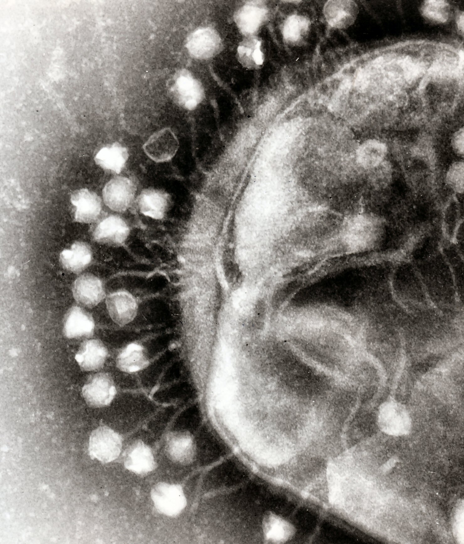 Un bacteriófago atacando la bacteria Escherichia coli. Imagen: Graham Beards