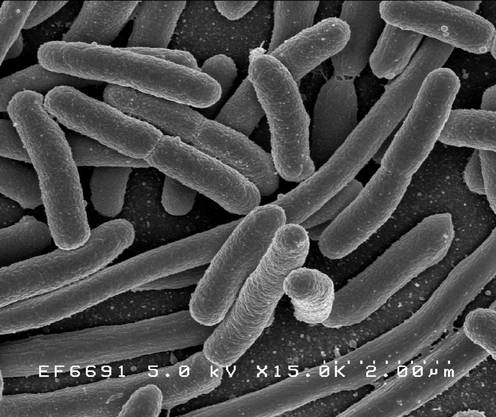 Micrografía electrónica de una agrupación de E. coli en un cultivo. Fuente: Rocky Mountain Laboratories, NIAID, NIH.