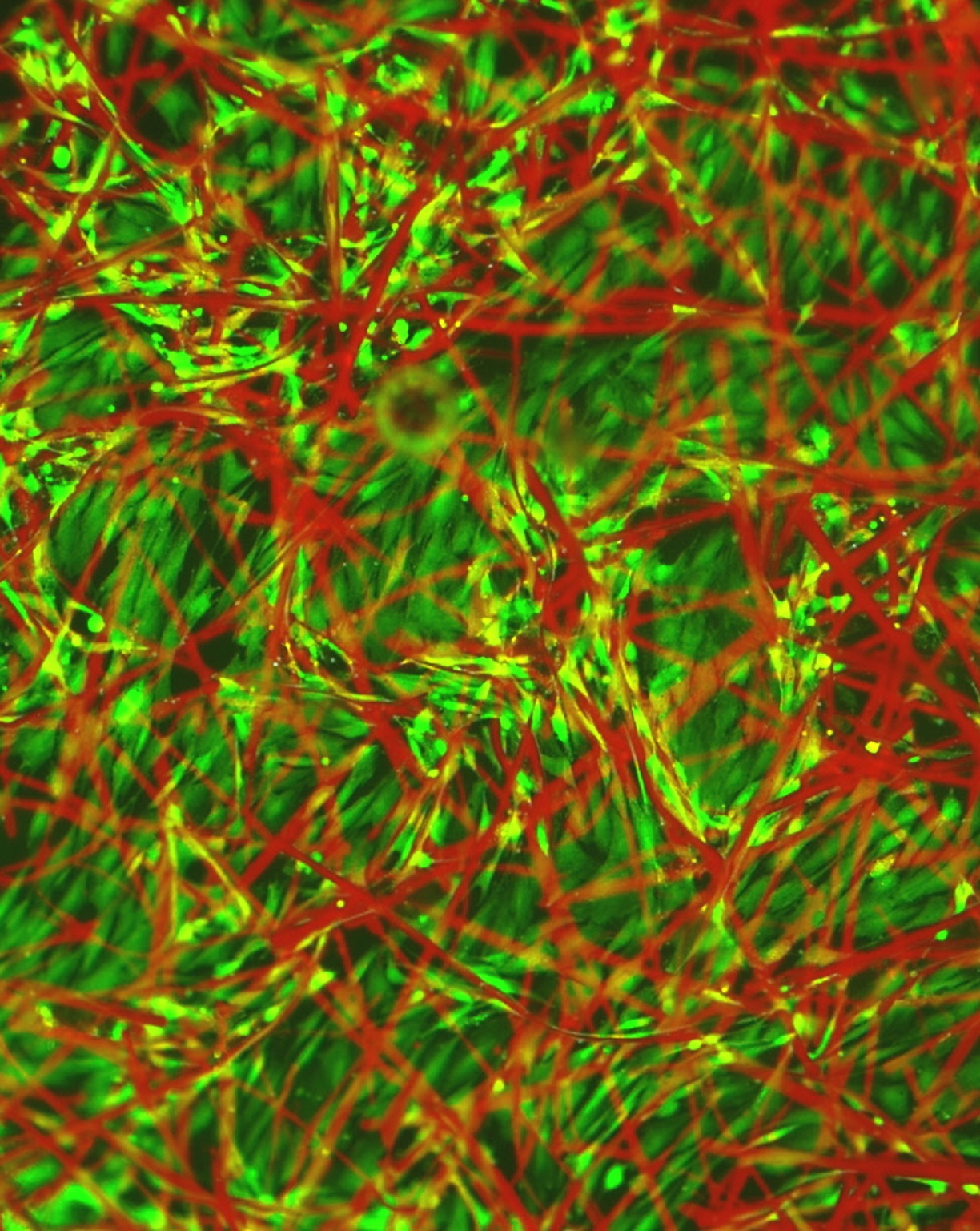 Fibras de TQ1 (en rojo) con cardiomiocitos o células embrionarias vivas del músculo cardiaco de pollos creciendo en ellas (verde). Fuente: AlphaGalileo.