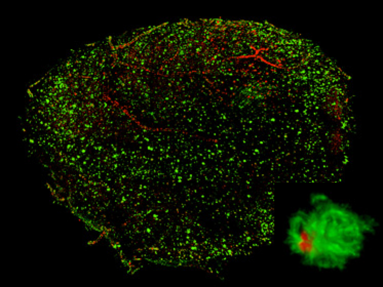 Visualización en 3D de placas beta amiloide en un cerebro de ratón. Abajo a la derecha, una placa en alta resolución. Fuente: Riken.