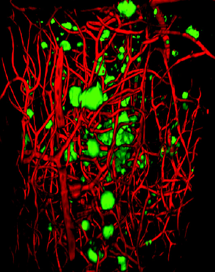 Otra visualización de placas beta amiloide. Fuente: Riken.