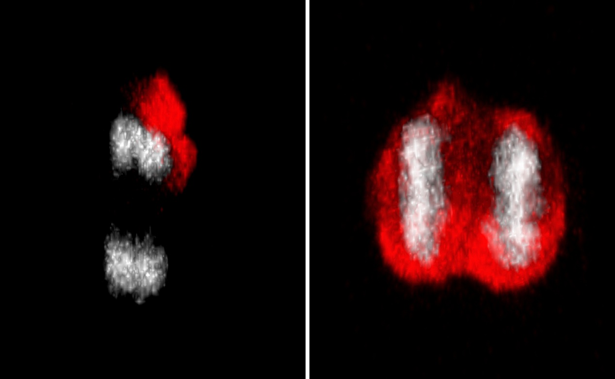 Las células madre segregan asimétricamente proteínas dañadas (en rojo) entre la célula madre y las células hijas (a la izquierda: ADN en gris). La responsable de esto es una barrera de difusión cuya fuerza se debilita con el avance de la edad. Este hecho propicia una asimetría reducida en la segregación de la proteína dañada (a la derecha). Fuente: UZH.