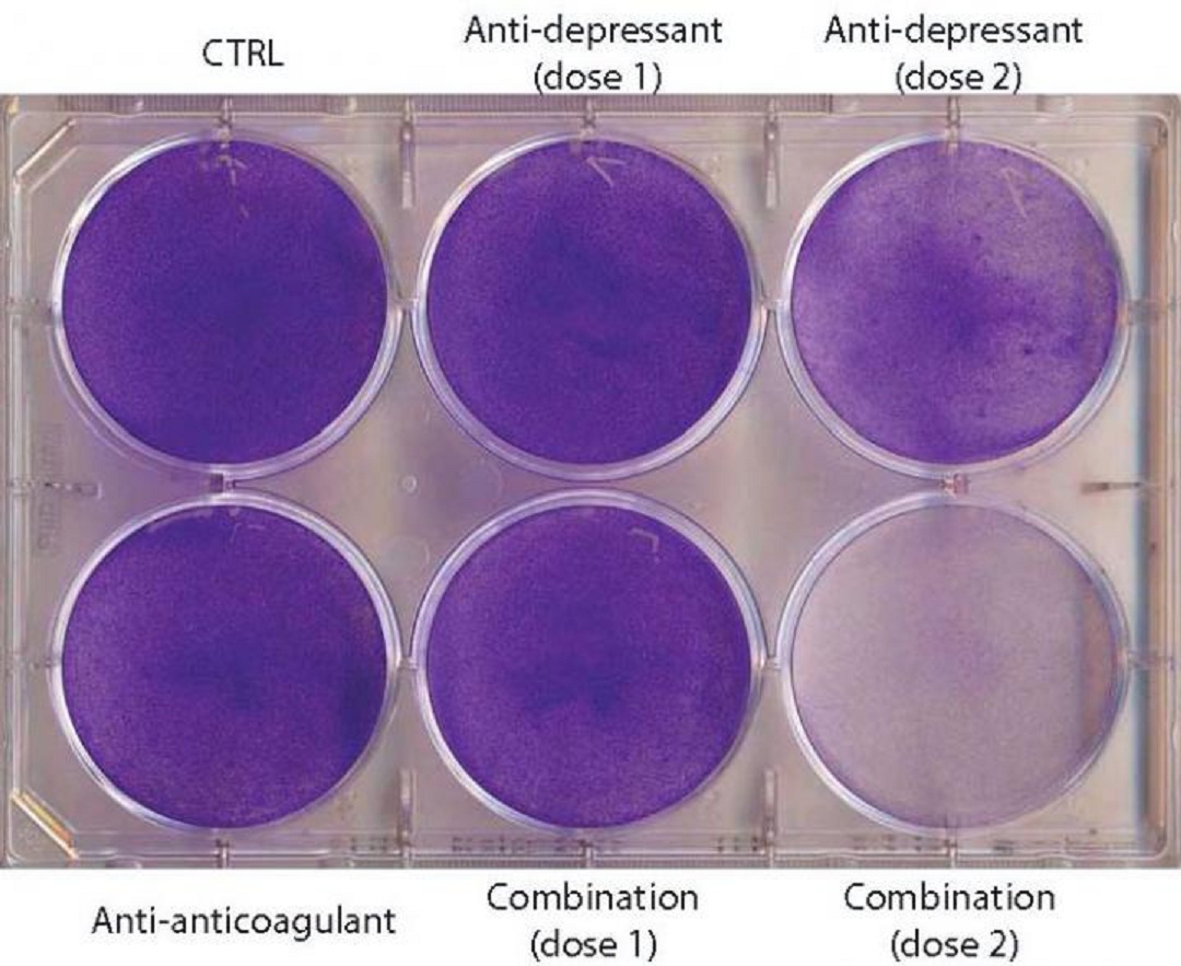 Tratamiento con anti-depresivo, combinado o no con anti-coagulante. El color morado indica la presencia de células cancerígenas vivas, mientras que el color claro indica que han muerto. Imagen: Douglas Hanahan. EPFL.