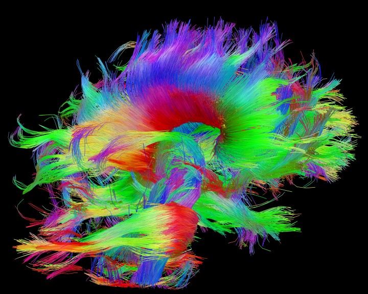 Esquema de la materia blanca del cerebro, realizado con imágenes por difusión espectral. Fuente: Human Connectome Project.