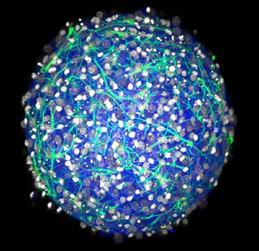 Los investigadores han creado minicerebros de neuronas. Imagen: Laboratorio Hoffman-Kim. Fuente: Universidad de Brown.