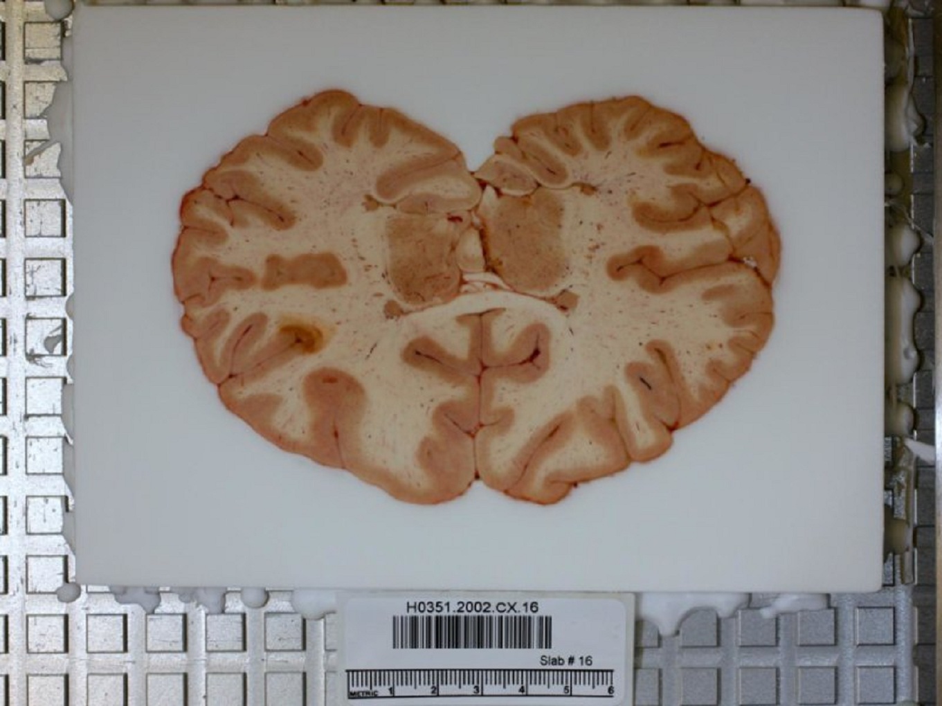 Material utilizado en el estudio. Fuente: Instituto Allen de Ciencia del Cerebro.