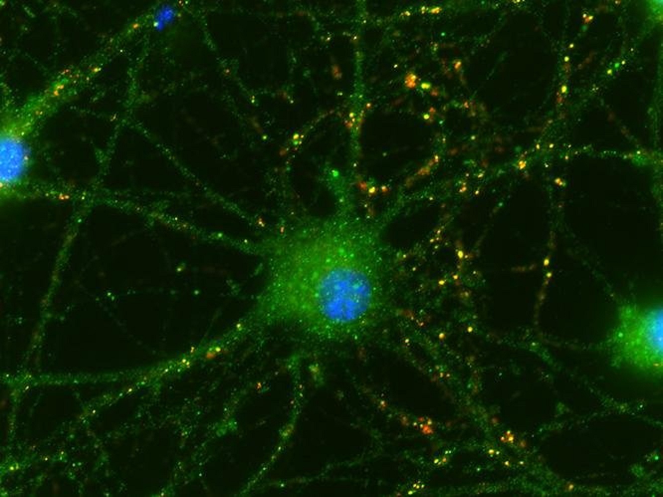 Células de cordón umbilical ayudaron a crear conexiones sinápticas (en amarillo) en las retinas de ratas. Imagen: Sehwon Koh. Fuente: Universidad de Duke