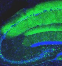 El fluorescente en verde y neuronas en azul. Scripps Research Institute.