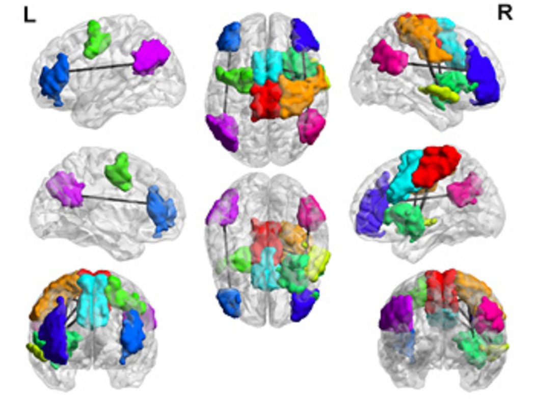 Las líneas unen las redes cerebrales conectadas. Imagen: Jeffrey Anderson. Fuente: Universidad de Utah.