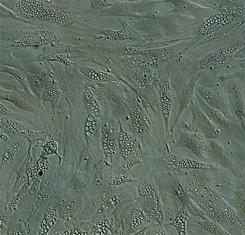 Vista al microscopio de adipocitos inmaduros. Fuente: UGR.