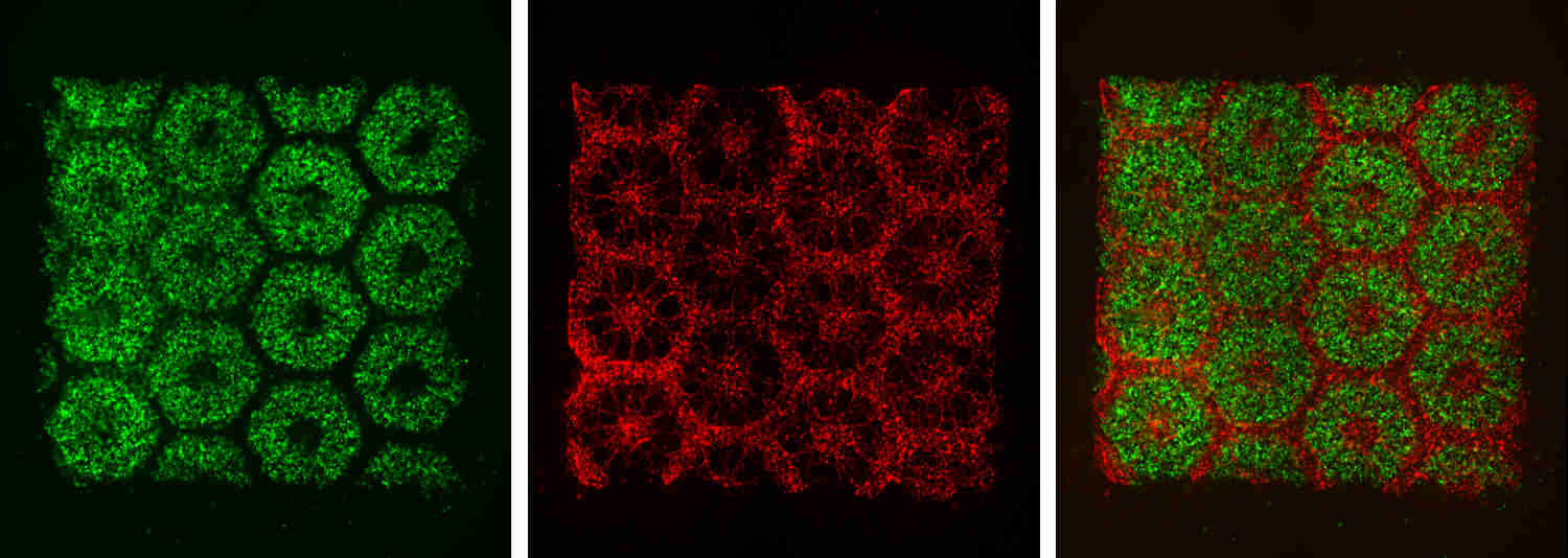 La imagen muestra células IPS (izq.), endoteliales y mesenquimales (centro) y la combinación resultante (dcha). Fuente: UC San Diego.