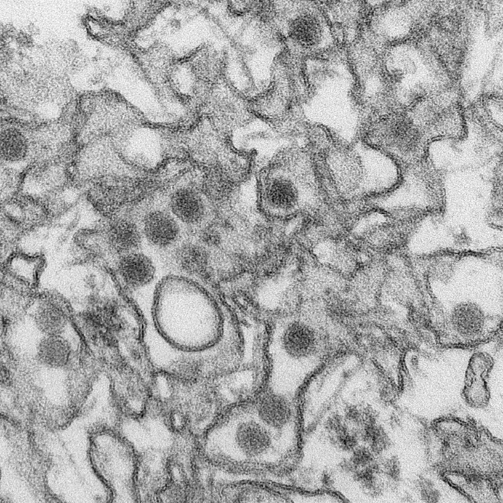 Micrografía electrónica por transmisión (TEM) del virus Zika. Imagen: Cynthia Goldsmith. Fuente: CDC.
