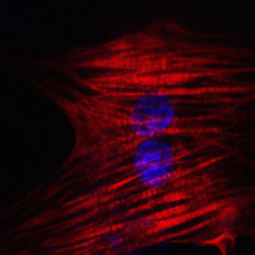 Célula del corazón reprogramada a partir de una célula de la piel. Imagen: Nan Cao. Fuente: Institutos Gladstone.