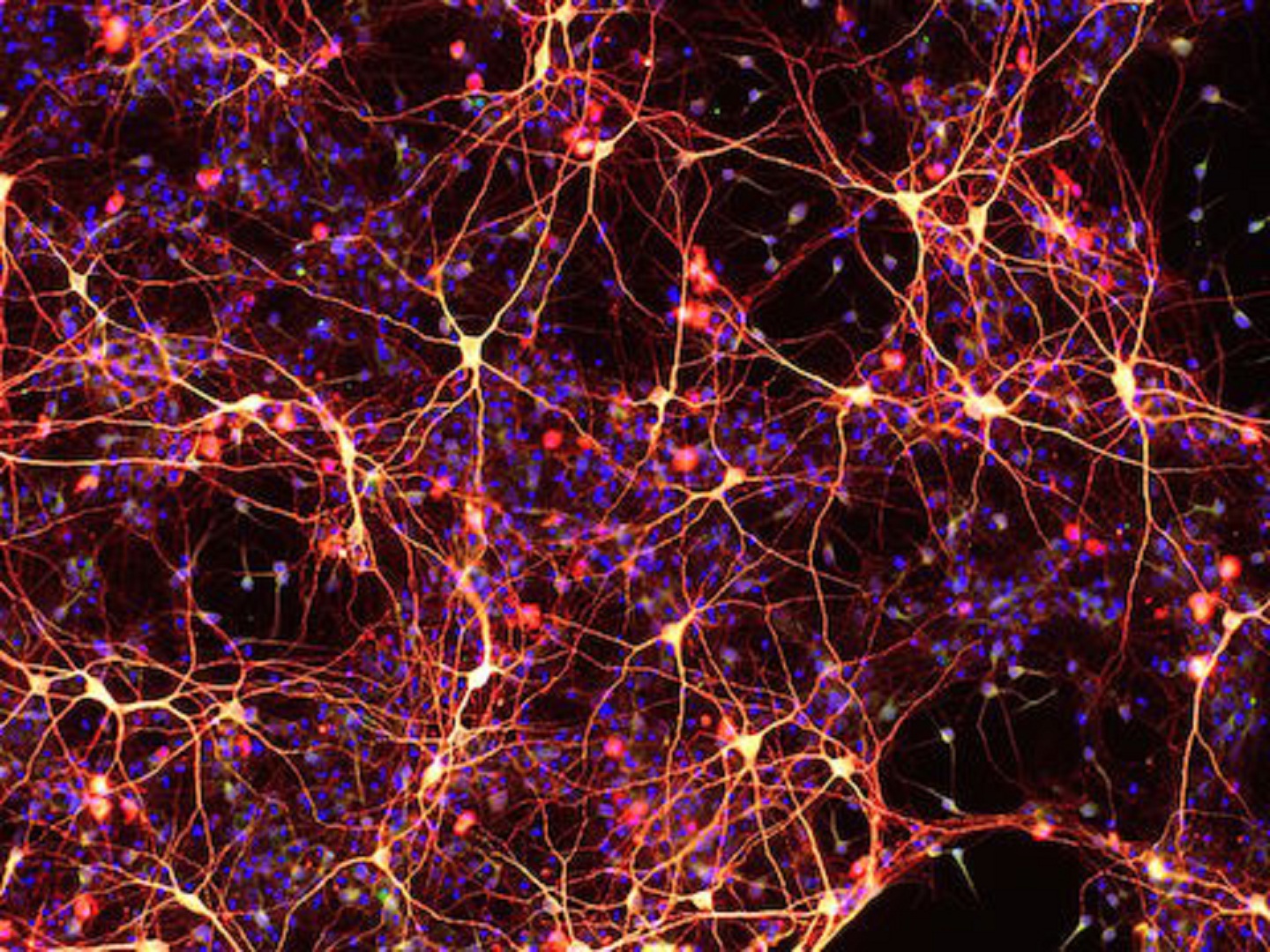 Neuronas creadas a partir de células madre neuronales químicamente inducidas. Imagen: M. Zhang. Fuente: Institutos Gladstone.