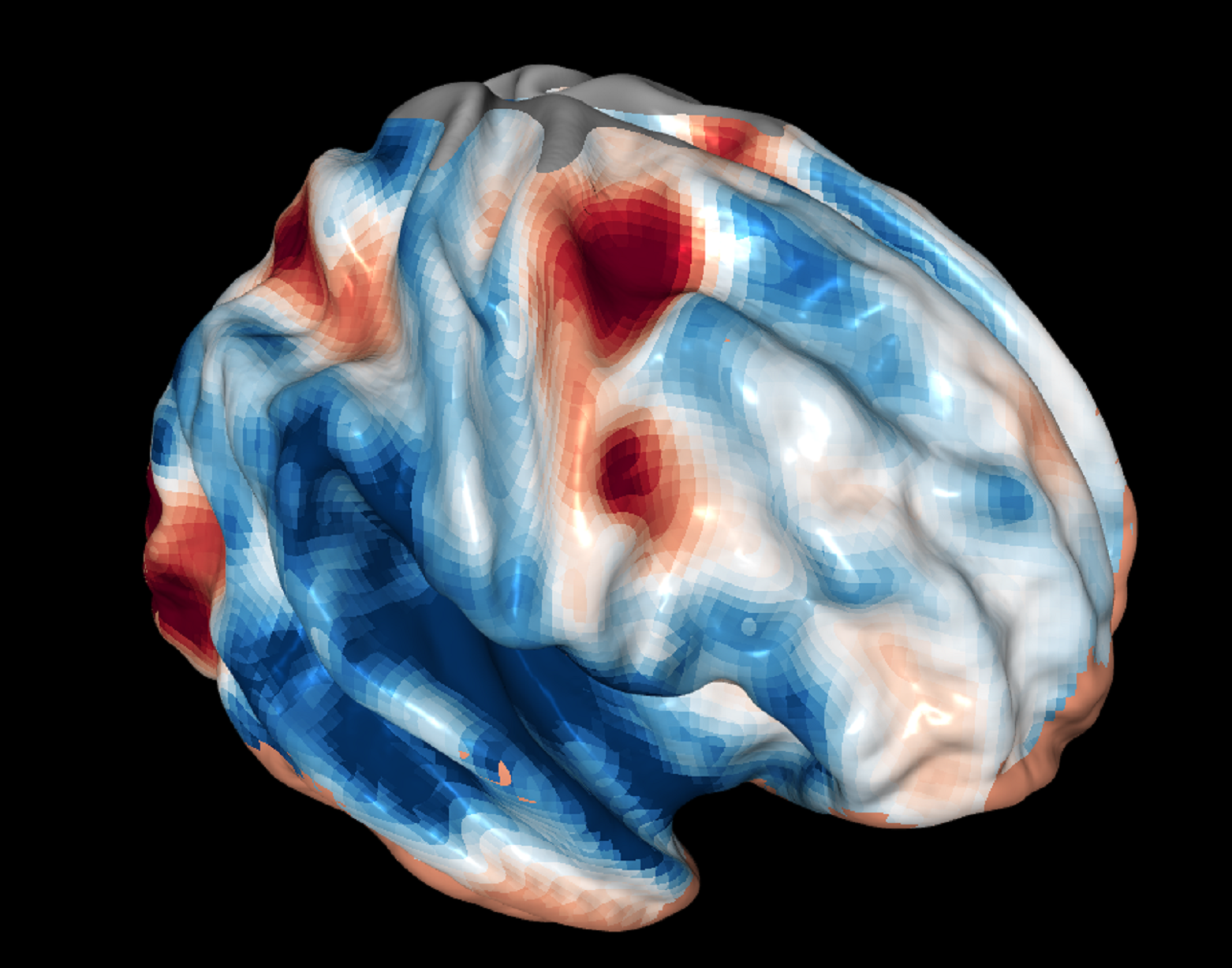 Imagen del cerebro de un escáner de resonancia magnética funcional durante pruebas del papel de la corteza frontal en la visión. Fuente: GA Tech.