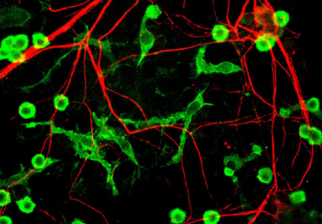 En esta imagen de microscopía se pueden apreciar neuronas (en verde) y la microglía con sus largas ramificaciones (rojo). Fuente: Universidad del País Vasco.