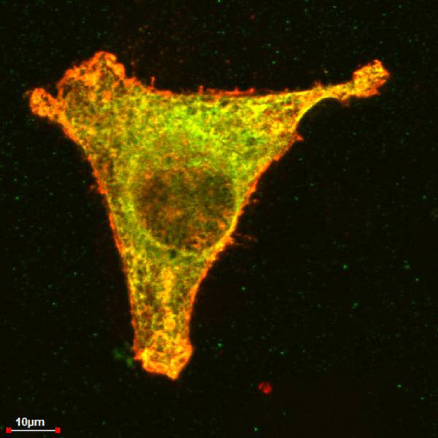 En una célula cancerígena, la talidomida hace que un complejo proteínico (en amarillo) desaparezca. Imagen: Bassermann. Fuente: TUM.