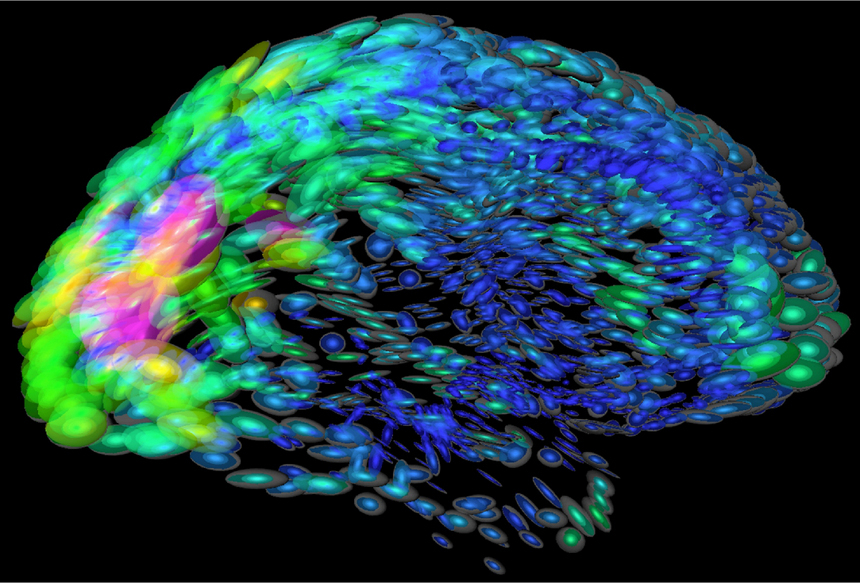 Mapa del cerebro. Universidad de Florida.