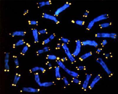 Los linfocitos (en azul) terminan en los telómeros (amarillos), más cortos en ancianos y personas que sufren estrés crónico. En estos últimos, la responsable sería la cortisona, la hormona que genera el organismo en situaciones de estrés. Fuente: U