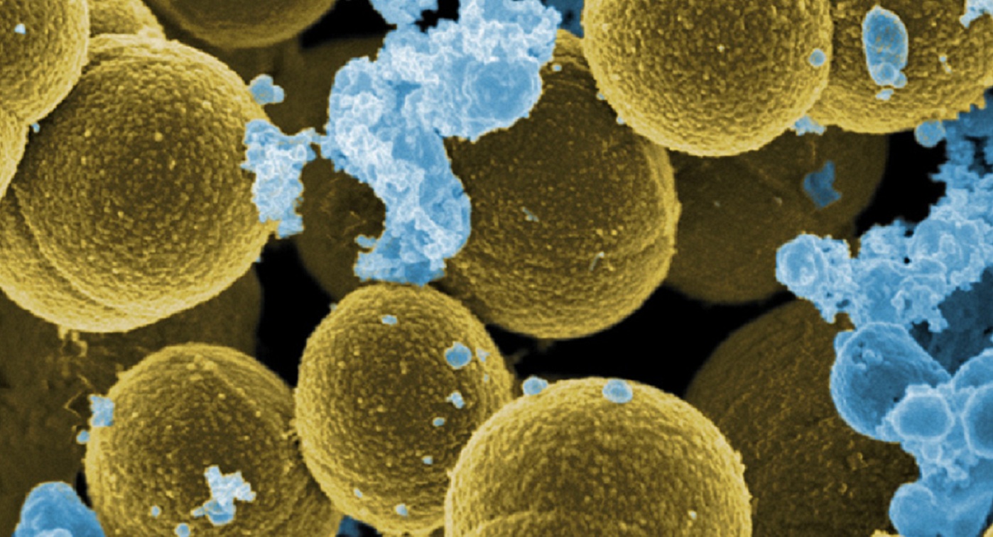 Bacteria  S. aureus escapando de la destrucción de las células blancas humanas. Imagen: NIAID/RML. Fuente: Wikipedia.