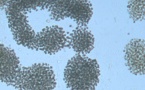 El embalse Las Conchas de Orense produce toxinas de guerra química