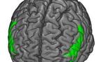 La hiperactividad y el consumo de drogas dependen de distintas redes neuronales