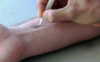 Un bolígrafo pinta sensores sobre la piel y otras superficies