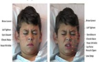 Un software identifica el nivel de dolor de los niños, a partir de sus expresiones faciales