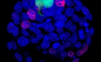 Encuentran nuevos datos sobre las células madres pluripotentes