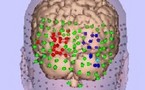 La resonancia magnética descubre zonas del cerebro que se iluminan mientras mentimos